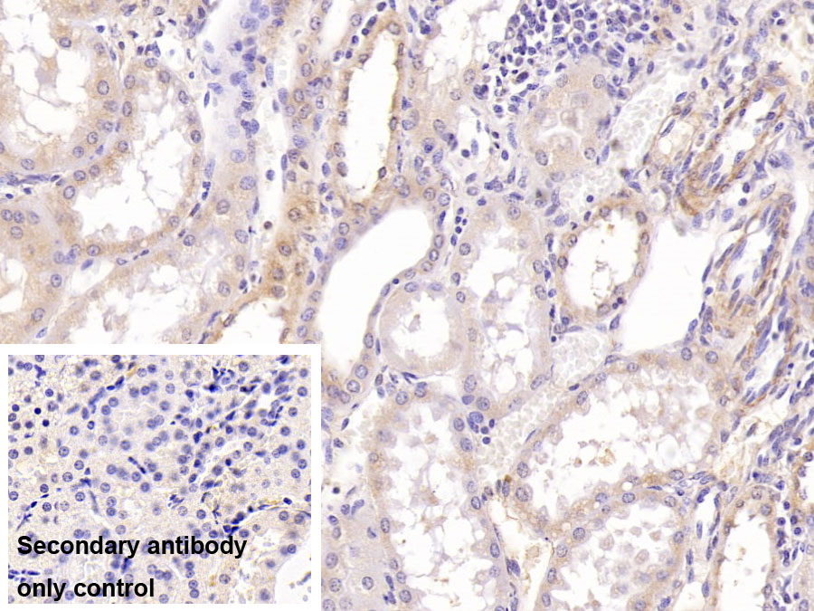 Monoclonal Antibody to Aspartate Beta Hydroxylase (ASPH)