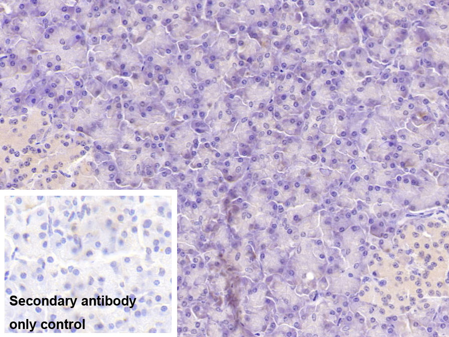 Monoclonal Antibody to Aspartate Beta Hydroxylase (ASPH)