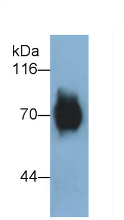 Monoclonal Antibody to Transcobalamin I (TCN1)