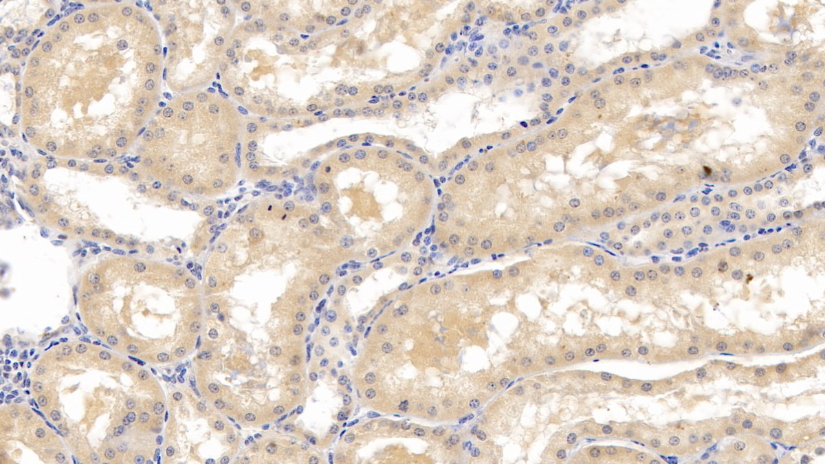 Monoclonal Antibody to Lecithin Cholesterol Acyltransferase (LCAT)