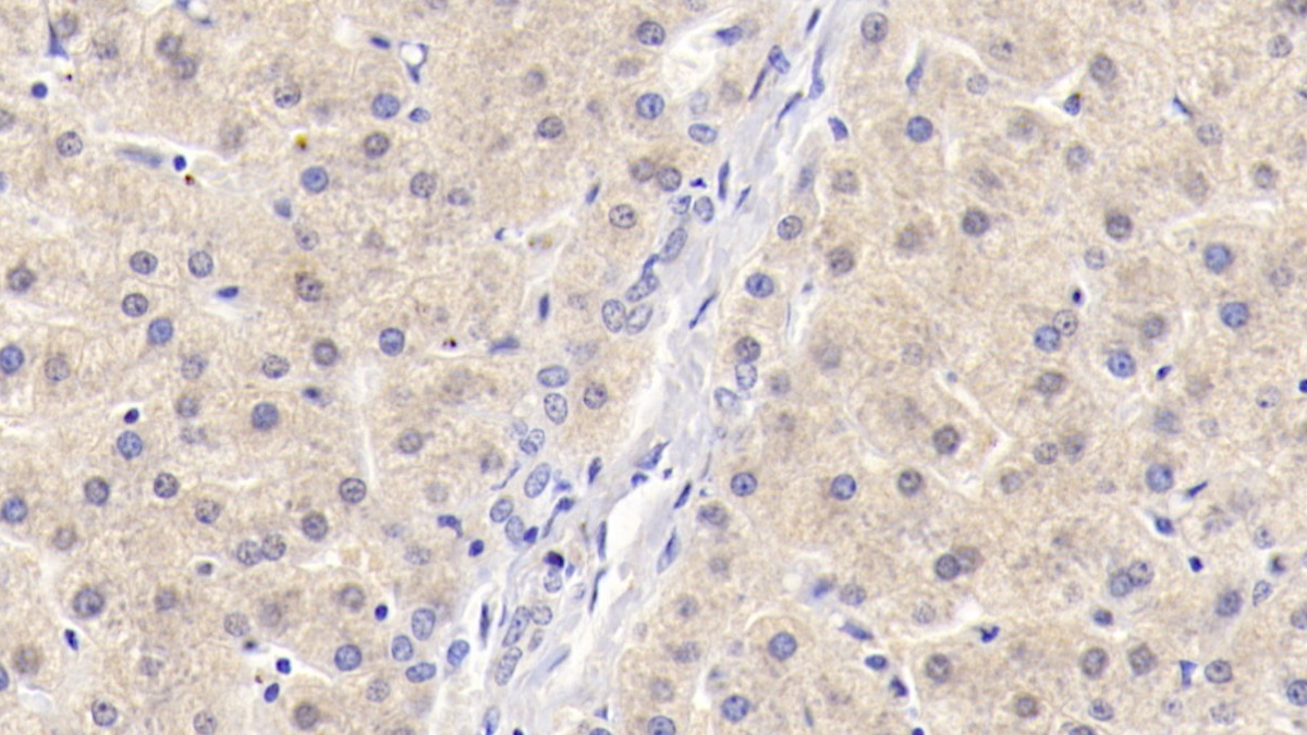 Monoclonal Antibody to Beclin 1 (BECN1)