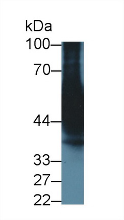 Monoclonal Antibody to Cytochrome P450 3A7 (CYP3A7)