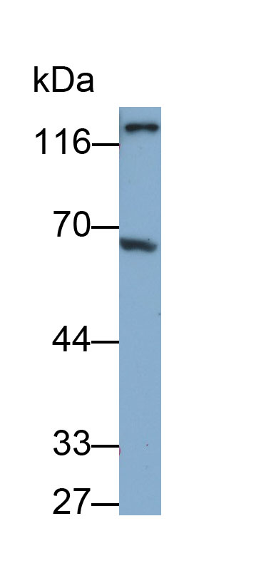 Polyclonal Antibody to Angiopoietin 2 (ANGPT2)