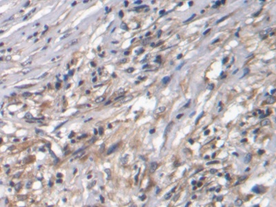Polyclonal Antibody to Connective Tissue Growth Factor (CTGF)