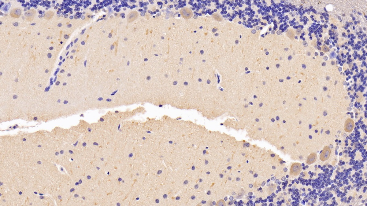 Polyclonal Antibody to Brain Derived Neurotrophic Factor (BDNF)