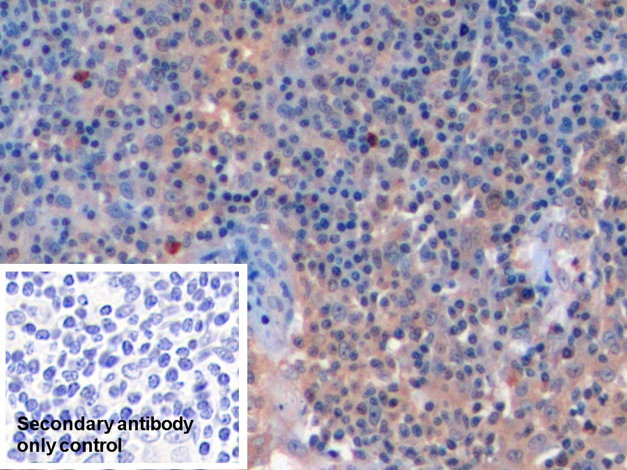 Polyclonal Antibody to Factor Related Apoptosis (FAS)