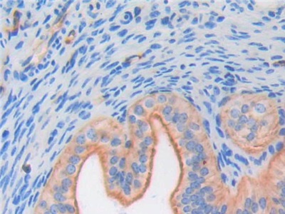 Polyclonal Antibody to Fibroblast Growth Factor 6 (FGF6)