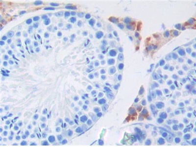 Polyclonal Antibody to Fibroblast Growth Factor 6 (FGF6)