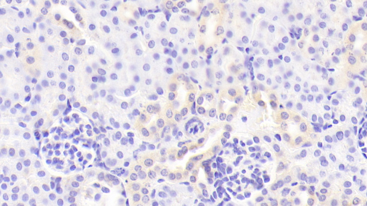 Polyclonal Antibody to Colony Stimulating Factor 2, Granulocyte Macrophage (GM-CSF)