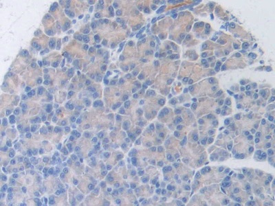 Polyclonal Antibody to Hepatocyte Growth Factor (HGF)