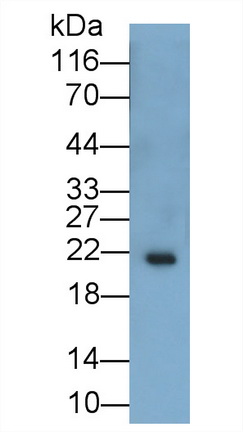 Polyclonal Antibody to Interleukin 11 (IL11)