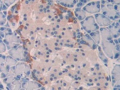 Polyclonal Antibody to Interleukin 18 (IL18)