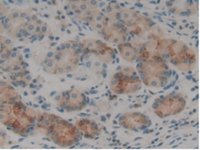 Polyclonal Antibody to Selectin, Leukocyte (SELL)