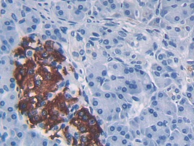 Polyclonal Antibody to Monocyte Chemotactic Protein 1 (MCP1)