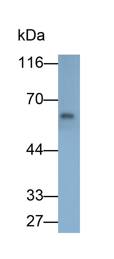 Polyclonal Antibody to Matrix Metalloproteinase 1 (MMP1)