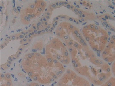 Polyclonal Antibody to Neurotrophin 4 (NT4)