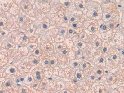 Polyclonal Antibody to Placenta Growth Factor (PLGF)