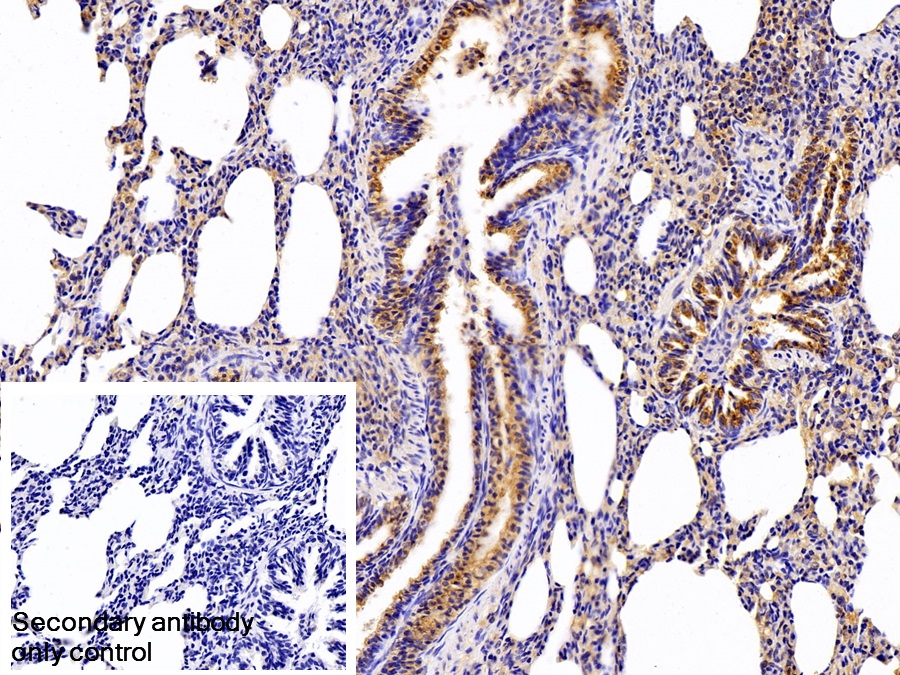 Polyclonal Antibody to Tissue Inhibitors Of Metalloproteinase 2 (TIMP2)