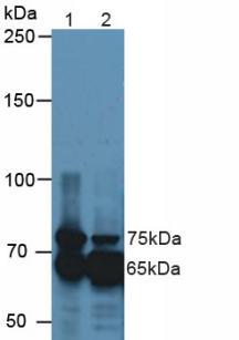 Polyclonal Antibody to Transforming Growth Factor Beta Induced Protein (TGFbI)