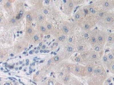 Polyclonal Antibody to Tumor Necrosis Factor Alpha (TNFa)
