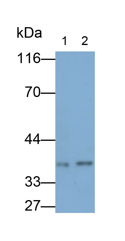 Polyclonal Antibody to Tumor Necrosis Factor Related Apoptosis Inducing Ligand (TRAIL)