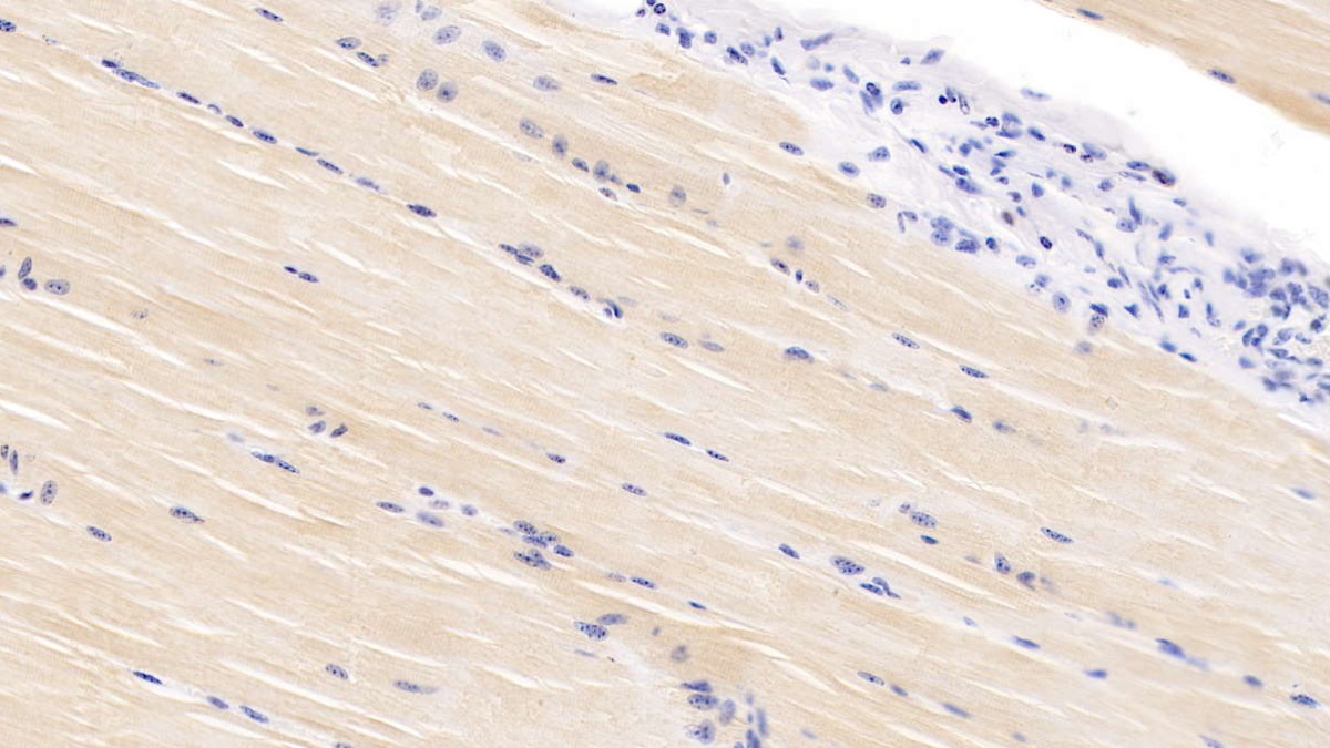 Polyclonal Antibody to Vascular Endothelial Growth Factor D (VEGFD)