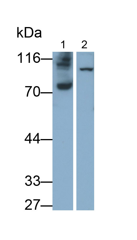 Polyclonal Antibody to Carcinoembryonic Antigen (CEA)