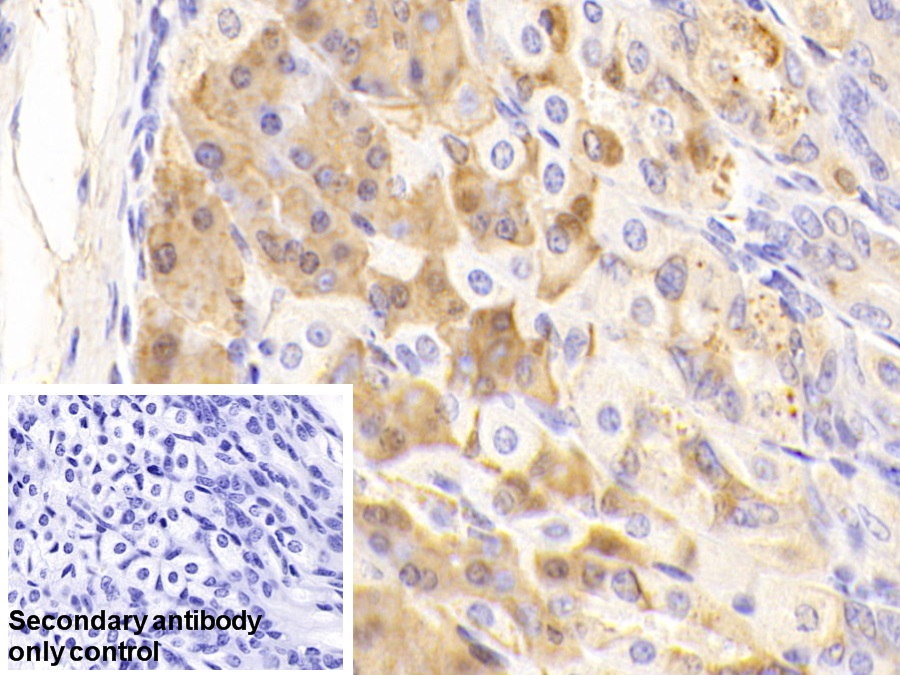 Polyclonal Antibody to Pepsinogen C (PGC)
