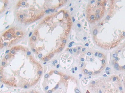 Polyclonal Antibody to Prostatic Acid Phosphatase (PAP)