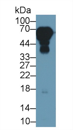 Polyclonal Antibody to Alpha-2-Heremans Schmid Glycoprotein (AHSG)