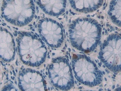 Polyclonal Antibody to Neutrophil Elastase (NE)