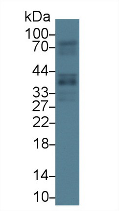 Polyclonal Antibody to Growth Arrest Specific Protein 2 (GAS2)