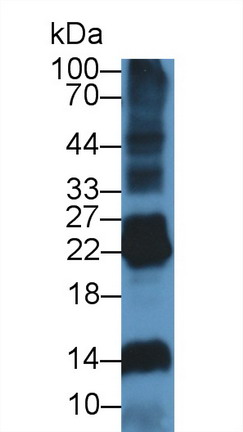 Polyclonal Antibody to Deoxyribonuclease I Like Protein 2 (DNASE1L2)