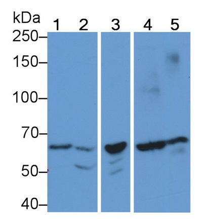 Polyclonal Antibody to Pyruvate kinase isozymes R/L (PKLR)