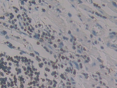 Polyclonal Antibody to Monocyte Chemotactic Protein 4 (MCP4)