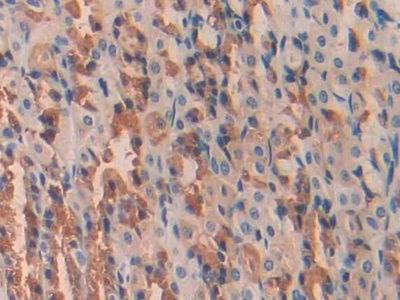 Polyclonal Antibody to Urocortin (UCN)
