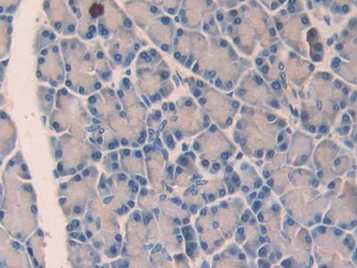 Polyclonal Antibody to Urocortin (UCN)