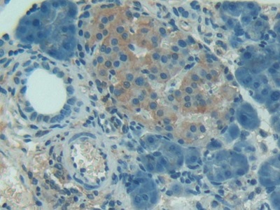 Polyclonal Antibody to Complement 1 Inhibitor (C1INH)