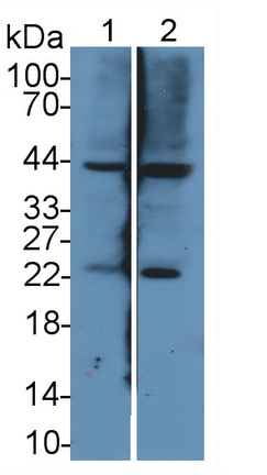 Polyclonal Antibody to Nesfatin 1 (NES1)