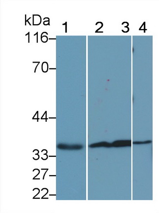 Polyclonal Antibody to Annexin V (ANXA5)