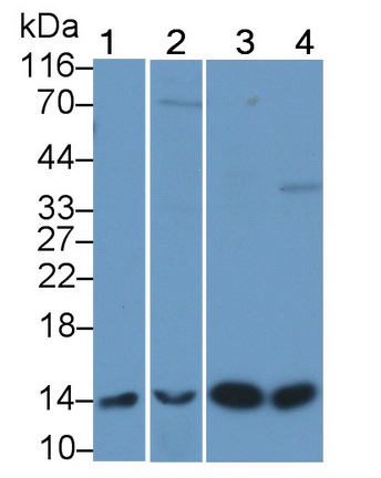 Polyclonal Antibody to Beta-2-Microglobulin (b2M)
