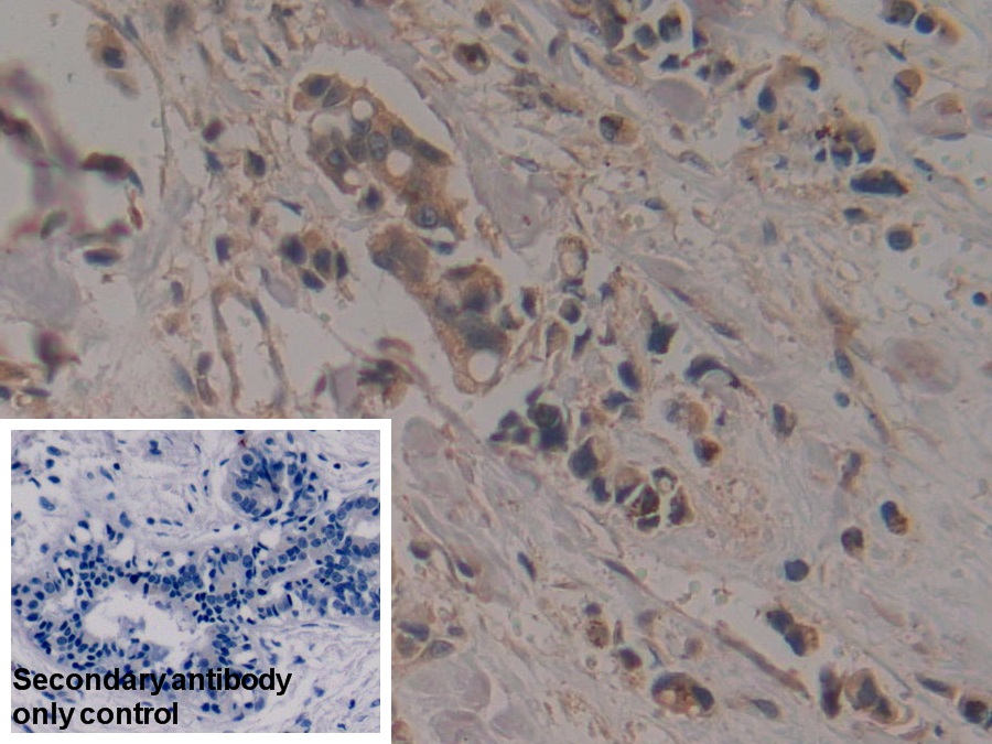 Polyclonal Antibody to Creatine Kinase, Mitochondrial 1A (CKMT1A)
