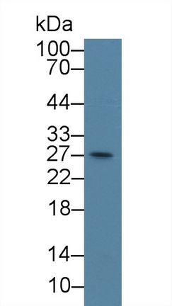 Polyclonal Antibody to Centromere Protein H (CENPH)