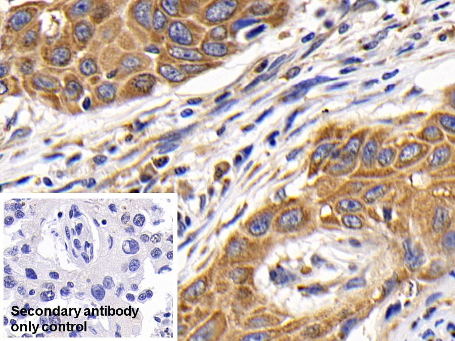 Polyclonal Antibody to Cathepsin K (CTSK)