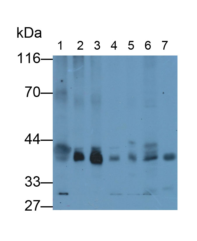 Polyclonal Antibody to Connexin 43 (CX43)