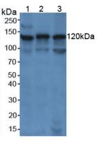 Polyclonal Antibody to Poly ADP Ribose Polymerase (PARP)