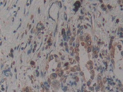 Polyclonal Antibody to Calnexin (CNX)