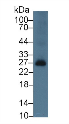 Polyclonal Antibody to B-Cell Activation Factor Receptor (BAFFR)