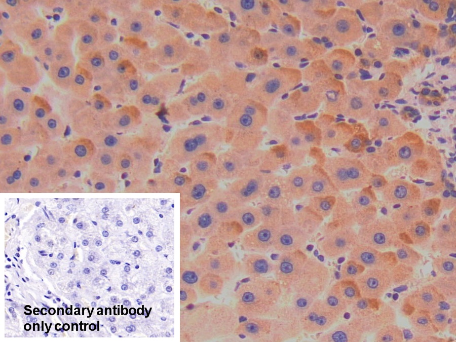 Polyclonal Antibody to Thyroxine Binding Globulin (TBG)