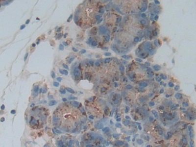 Polyclonal Antibody to Cathepsin L (CTSL)